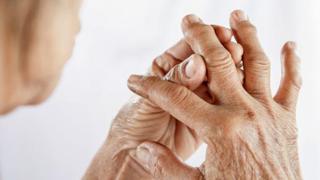 ¿Tronarse los dedos produce artritis? Esto dicen los expertos
