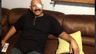 Óscar D'León volverá a ser operado tras accidente que casi le cuesta un ojo