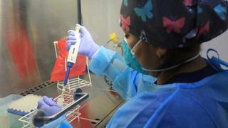 Viruela del mono en Perú: INS confirma “transmisión comunitaria” a nivel nacional de esta enfermedad