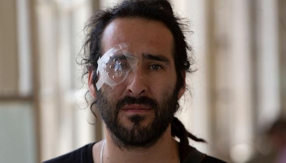 El Instituto Nacional de Derechos Humanos de Chile ha contabilizado 222 personas con heridas en los ojos en los hospitales locales. (Foto: AFP)