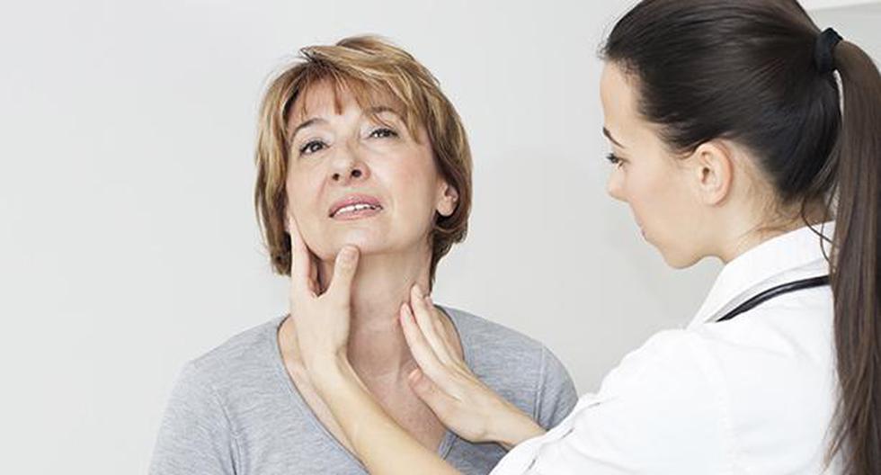 El cáncer de tiroides afecta a muchas personas en el mundo. (Foto: IStock)