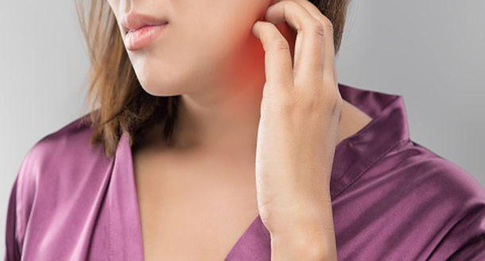 La dermatitis atópica se caracteriza por picor intenso. (Foto: GettyImages)
