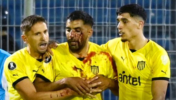Rosario Central vs Peñarol: Maximiliano Olivera fue agredido con proyectil y sufrió desmayo | VIDEO