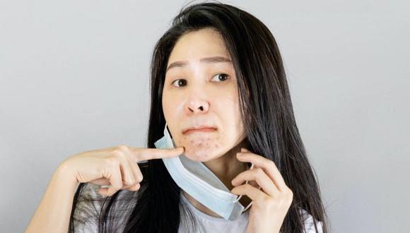 Son varios los especialistas que hablan del incremento de casos de acné por el uso continuado de la mascarilla. (Foto: Getty Images)
