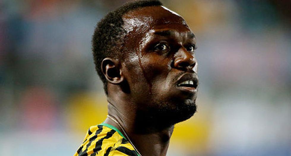 Usain Bolt, sufre una lesión en la corva a tres meses de los Juegos Olímpicos Río 2016 | Foto: Getty
