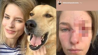 “Vi mi ojo empapado en sangre”: El feroz ataque de un perro a la modelo que lo rescató de un refugio de animales 