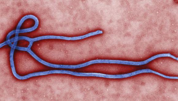 Ébola: enfermos de EE.UU. se convierten en conejillos de indias