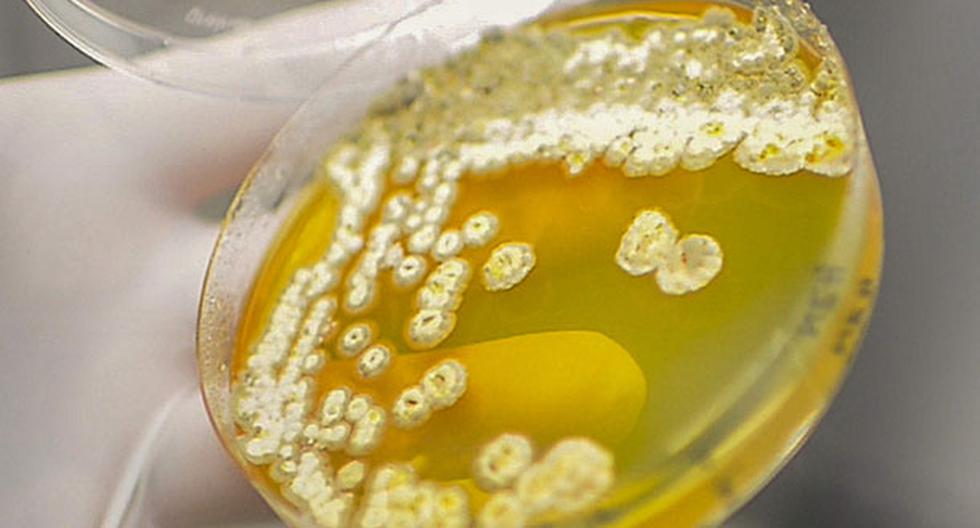 Este antibiótico inhibe el crecimiento del hongo \"Candida albicans\", que causa infección y manchas en la piel y boca de las personas. (Foto: EFE)