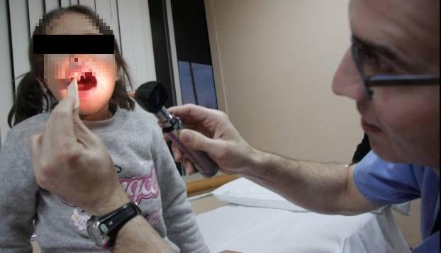 Los pacientes seleccionados serán operados gratuitamente y recibirán terapias del lenguaje (Foto: Difusión)