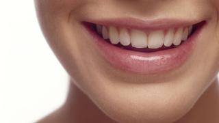 Estética para sonrisas luminosas: Blanqueamiento dental