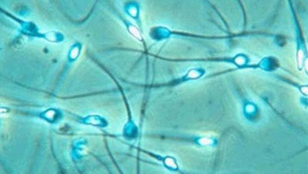 Semen protege al VIH de los antivirales