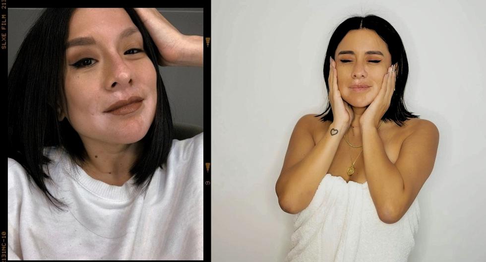 Día Mundial del Vitiligo: el inspirador testimonio de la blogger peruana  Soledad Valenzuela | ENTREVISTA | salud | piel | belleza | VIU | EL  COMERCIO PERÚ