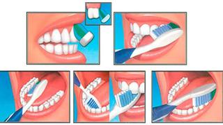 Salud bucal: ¿cuál es la manera correcta de cepillarse los dientes?