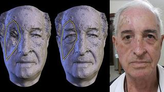 Peruano está cambiando la forma de hacer prótesis faciales [ENTREVISTA]