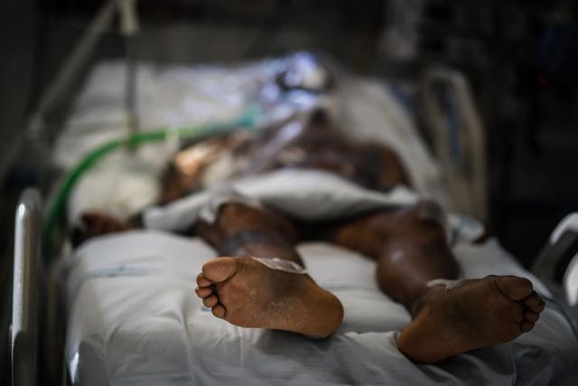 Detalle de los pies de un paciente con COVID-19 en el Hospital del Bicentenario de Esteban Echeverria el 30 de julio de 2020, en Buenos Aires (Argentina). (EFE/ Juan Ignacio Roncoroni).