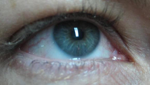 Muchas enfermedades pueden presentar señales en los ojos. (EUROPA PRESS)