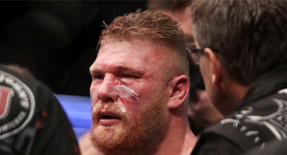 Brock Lesnar perdió la pelea y el título Peso Pesado ante Cain Velásquez en UFC 121 | Foto: UFC