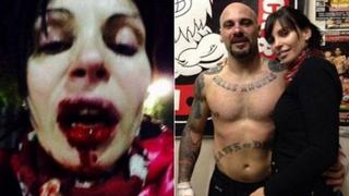 Un boxeador argentino desfiguró a su pareja