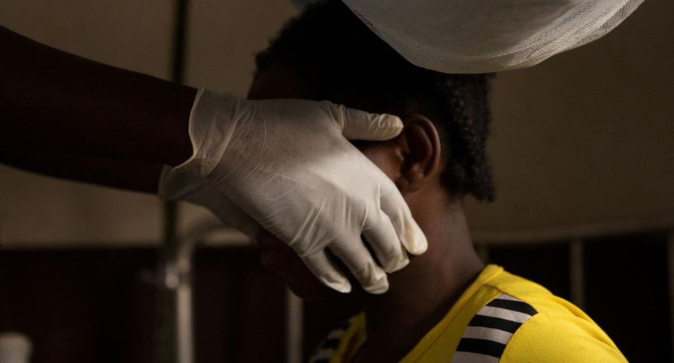 Un médico examina a una mujer infectada con viruela del simio en un área de cuarentena del centro de la ONG médica internacional Médicos Sin Fronteras (MSF), en Zomea Kaka, en la región de Lobaya, el 18 de octubre de 2018 (Foto: Charles Bouessel / AFP)