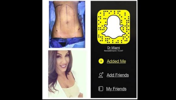 Snapchat: médico cirujano transmite sus operaciones por la red