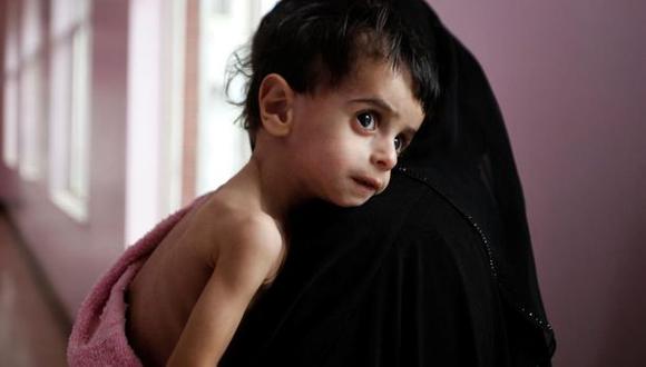 La mirada perdida de un chico en brazos de su madre en el hospital de Sanaa. (Foto: Reuters / Khaled Abdullah)