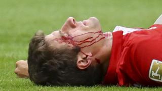 Thomas Müller quedó 'noqueado' tras choque con Héctor [FOTOS]
