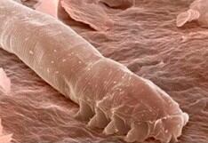 Dermatólogo revela los diminutos insectos que viven en la cara de todos