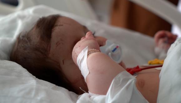 Esta bebé de seis meses, cuya cara está cubierta de cicatrices, solo es conocida como &quot;anónima&quot; por su etiqueta.
