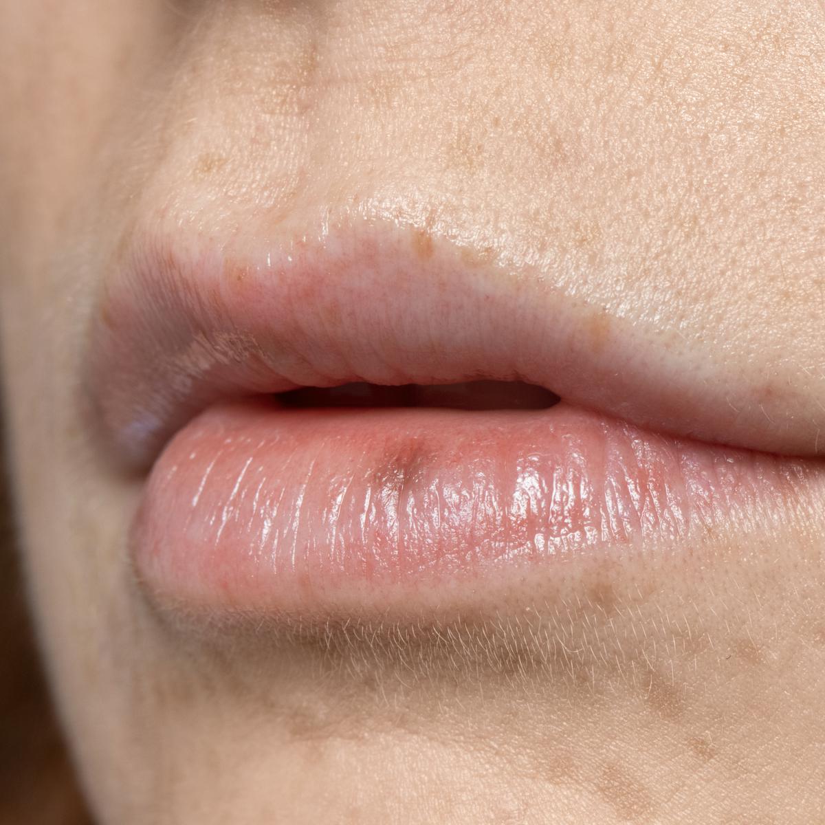 El brillo de labios o 'gloss' aumenta el riesgo de cáncer de piel