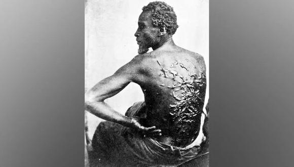 La verdadera historia de “Peter azotado”, el esclavo cuya desgarradora fotografía cambió la percepción de la esclavitud en Estados Unidos. (GETTY IMAGES).