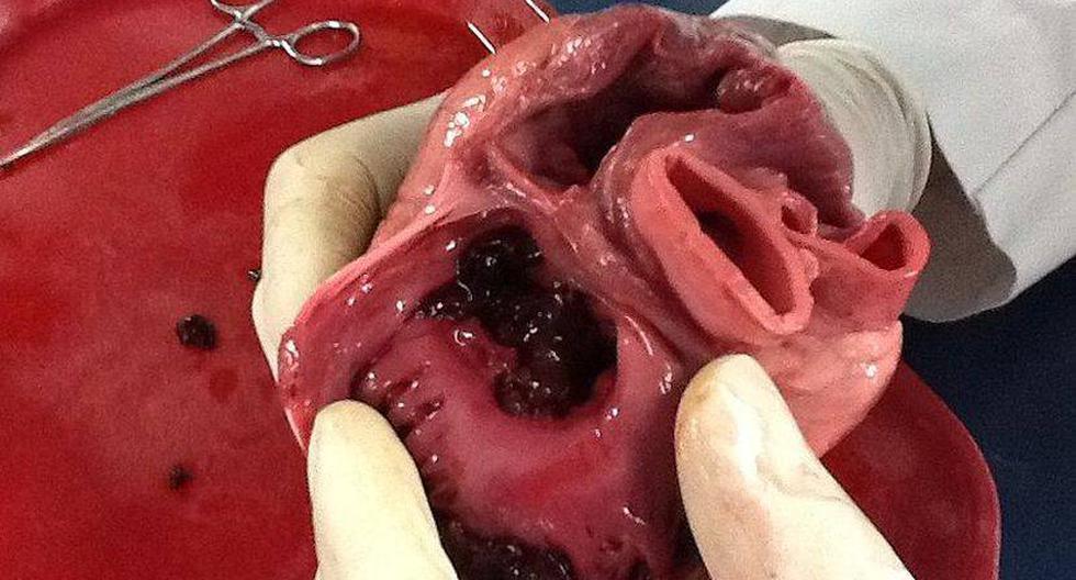 Un corazón hecho con impresión en 3D costaría menos que un órgano real. (Foto: wikimedia.org)