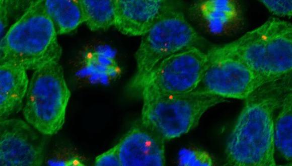 El cáncer secuestra células sanas para propagarse por el cuerpo