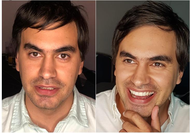 Esta técnica logra minimizar los riesgos de los tratamientos dentales en casi un 100%.