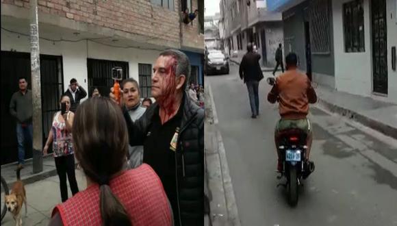 Gerente de Seguridad Ciudadana de la Municipalidad de Los Olivos sufrió golpes en la cabeza tras enfrentamiento con presuntos "cobradores de cupos". (Foto: Difusión)
