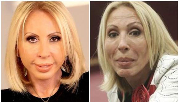 Laura Bozzo se hizo cirugía: "Me siento de 30 años"