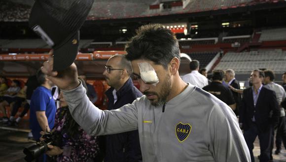 Copa Libertadores 2018: Pablo Pérez fue uno de los principales heridos tras el incidente con el bus de Boca Juniors | Foto : AFP