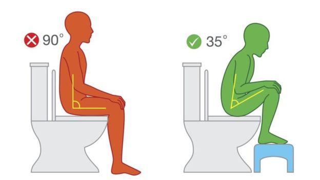 Elevar las rodillas al ir al baño para cambiar el ángulo pélvico de 90 a 35 grados podría ayudar a relajar tus intestinos. (GETTY IMAGES)