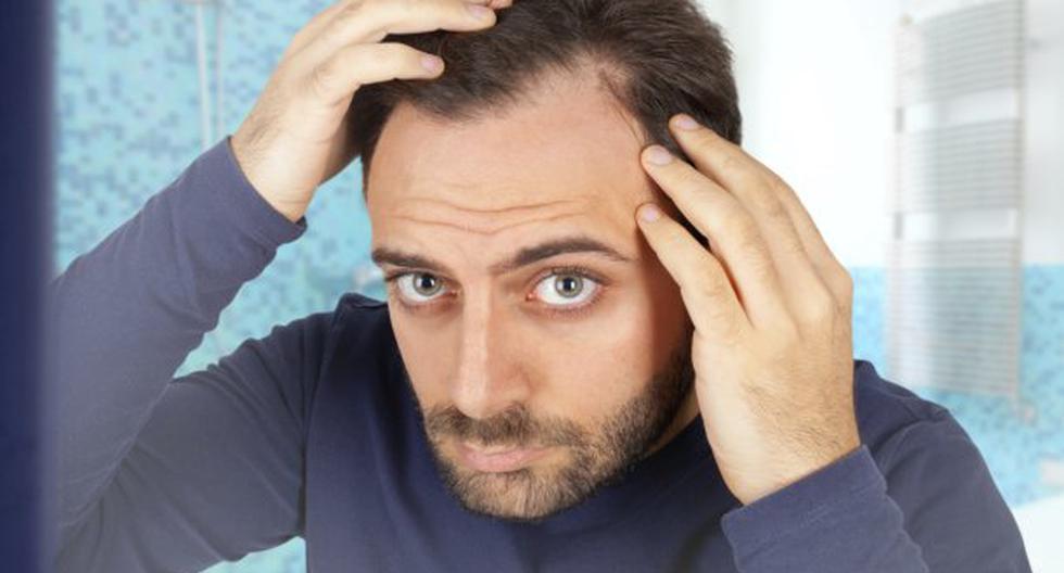 La caída del cabello puede provocar inseguridad en el hombre. (Foto: ThinkStock)
