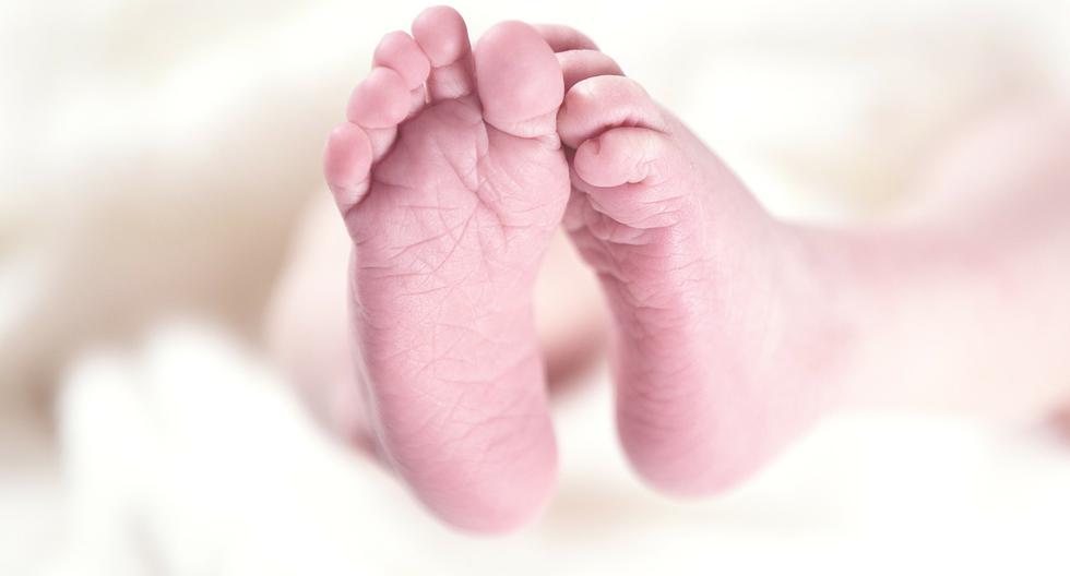 Saúde |  O estranho caso do bebé que nasceu sem rosto e que está a causar polémica em Portugal |  TECNOLOGIA