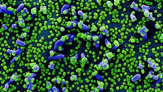 Coronavirus | Cómo se ve el virus cuando invade una célula humana | FOTOS