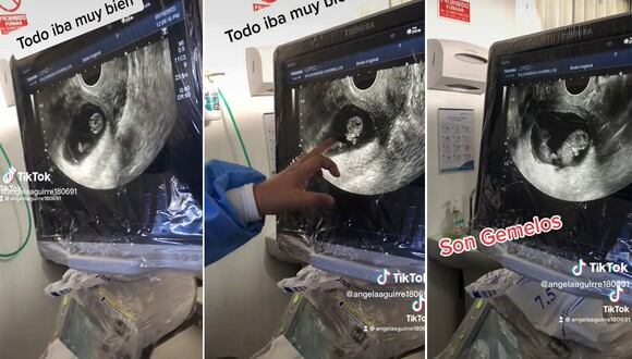Una mujer quedó en shock al enterarse que espera gemelos. | FOTO: @angelaaguirre180691 / TikTok