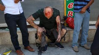 Turquía: Brutal atentado suicida deja al menos 30 muertos