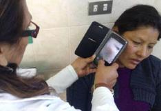 Lima: presentan aplicativo móvil que detecta cáncer de piel