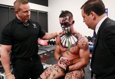 WWE: Finn Bálor renuncia al Título Universal por una fuerte lesión