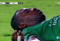 YouTube: Futbolista sufre terrible golpe en la cabeza durante partido | VIDEO 