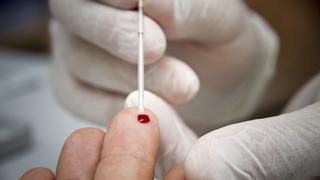 ¿Por qué el mundo está cerca de erradicar el VIH pero lejos de hallar una cura?