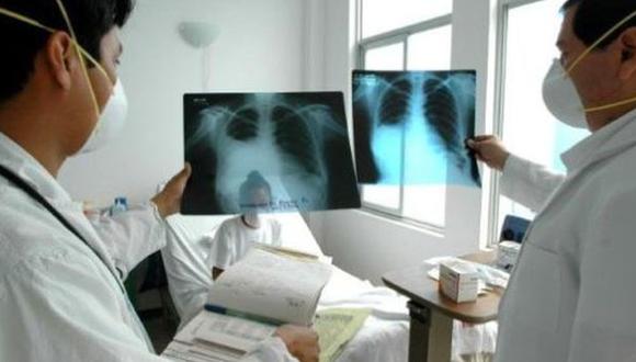 Muertes por tuberculosis se redujeron a la mitad en América
