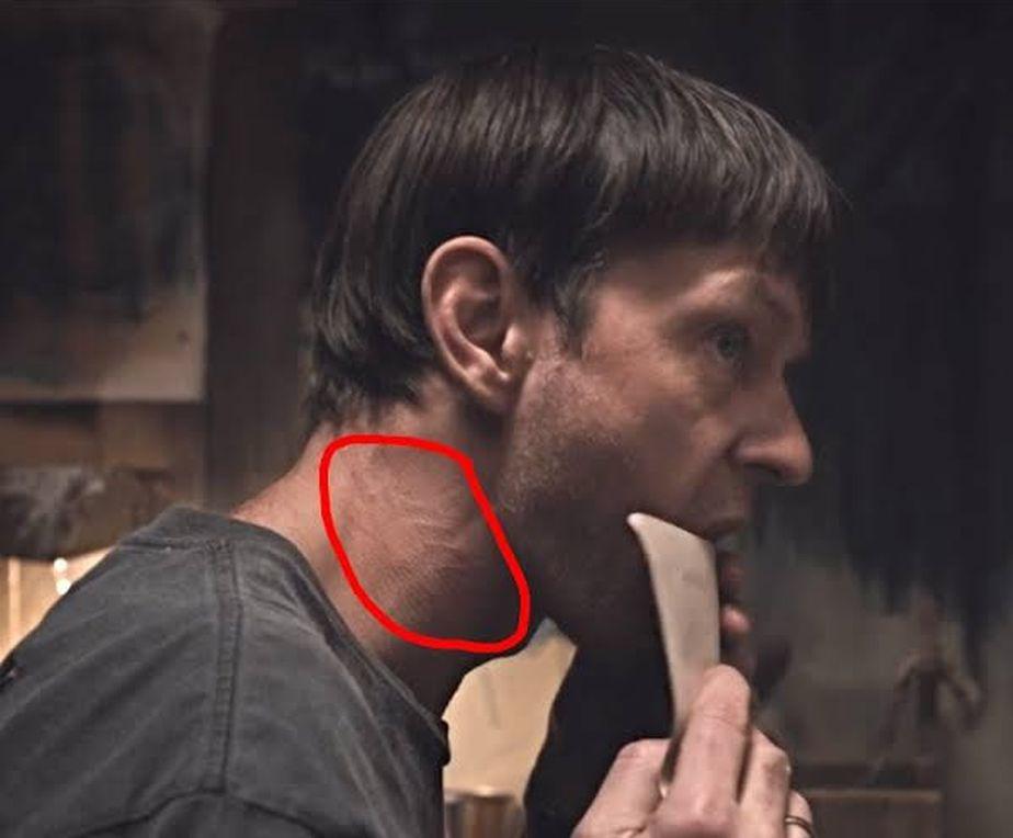 Para los fans, esta cicatriz es la prueba que delata a Mikkel (Foto: Dark / Netflix)