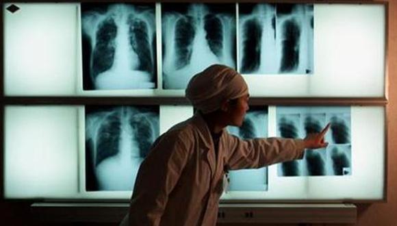 Aumentan los casos de tuberculosis resistente a fármacos