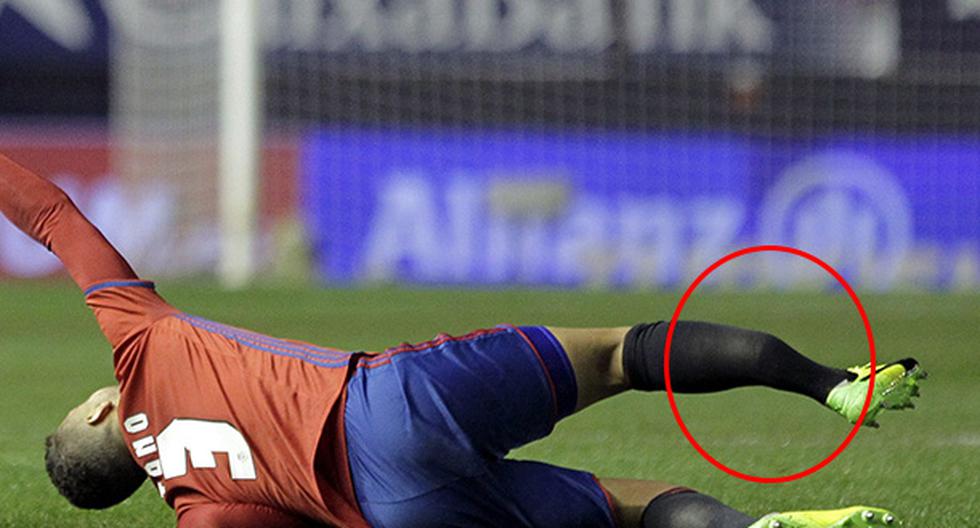 Real Madrid vs Osasuna: Bennín sufrió terrible lesión. (Foto: EFE)